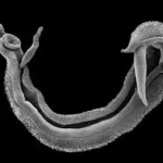 Schistosomiasis – Gejala, Penyebab dan Cara Mengobati